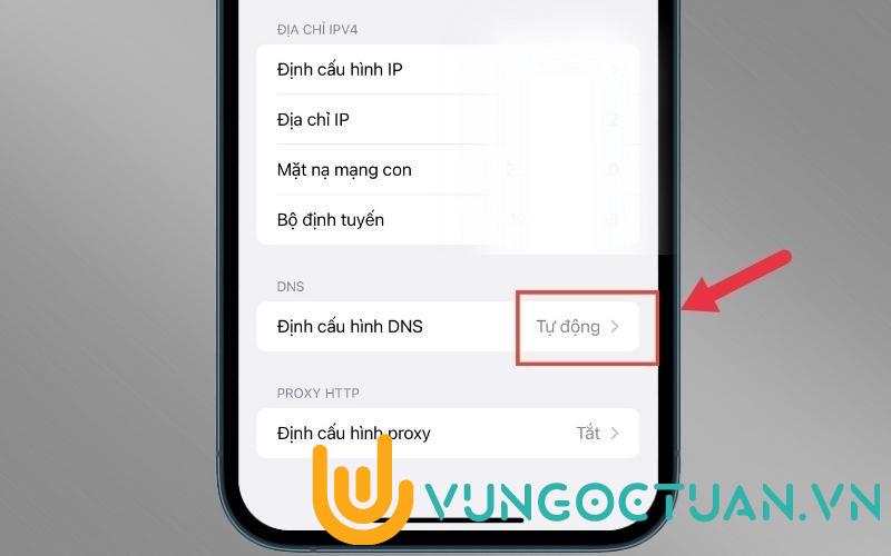 Tìm đến phần DNS > Nhấn Định cấu hình DNS
